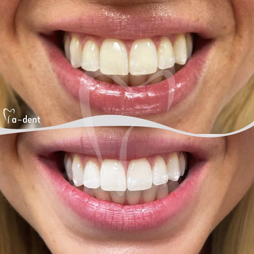 Slider image (4) A-dent Dental Clinic